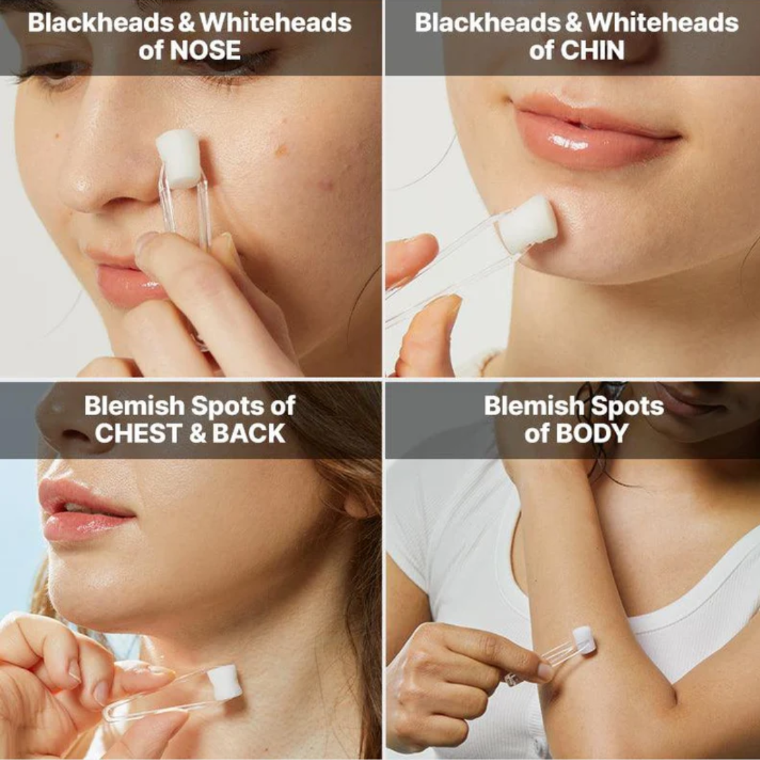 COSRX The AHA 2 BHA 2 Blemish Treatment