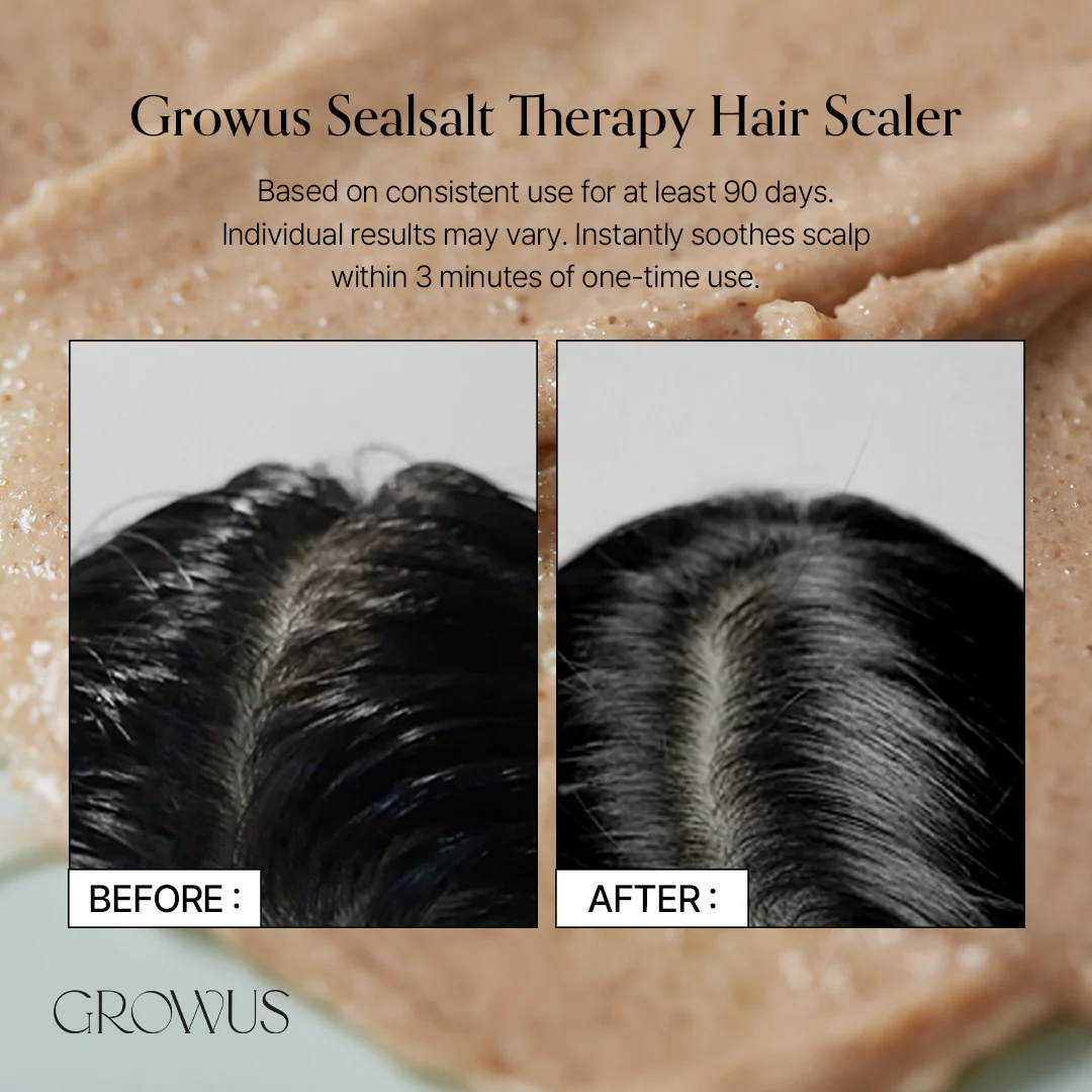 GROWUS Sea Salt Therapy Scalp Scaler 120g