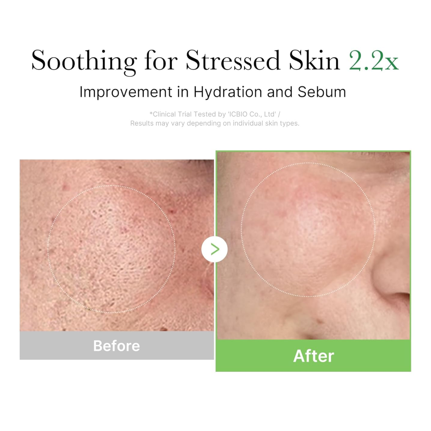 MEDICUBE Exosome Cica Cream 50ml