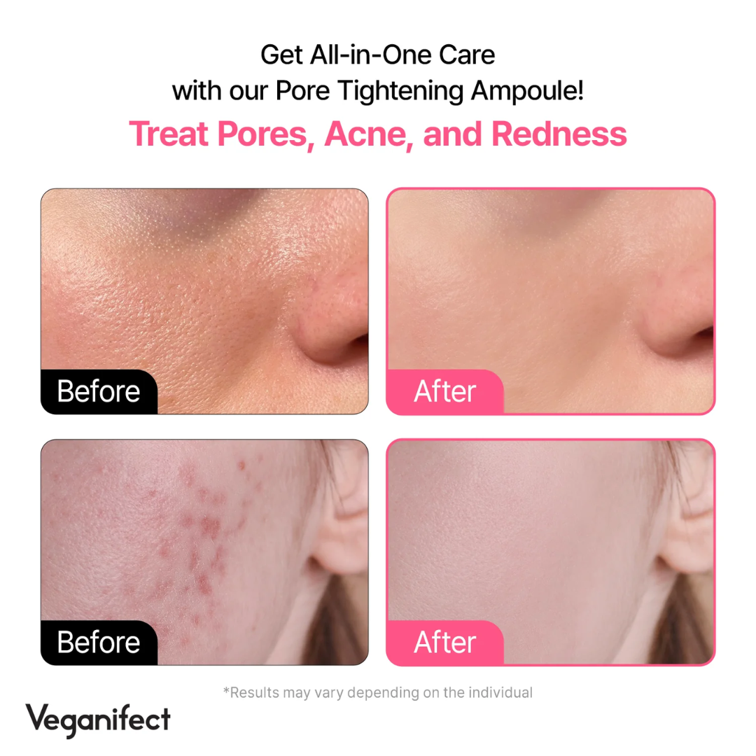 VEGANIFECT Pore Refining Fig Chestnut Ampoule 50ml
