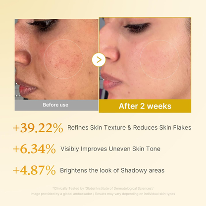 MEDICUBE Kojic Acid Turmeric Resurfacing Toner 250ml